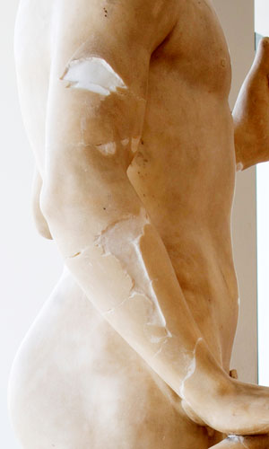 7. Tullio Lombardo's Adam--A Masterpiece Restored_Right Arm During Fills-Switch Removed_MMA (2)000.jpg
